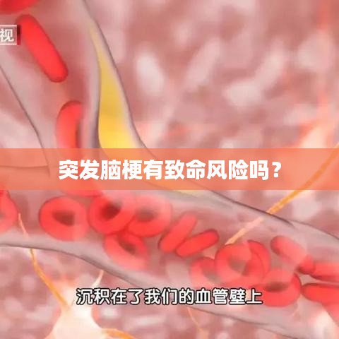 突發(fā)腦梗有致命風險嗎？