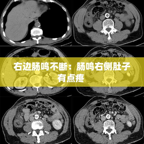 右邊腸鳴不斷：腸鳴右側(cè)肚子有點(diǎn)疼 