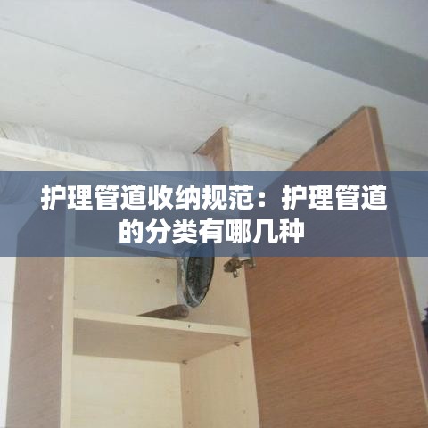 護理管道收納規(guī)范：護理管道的分類有哪幾種 