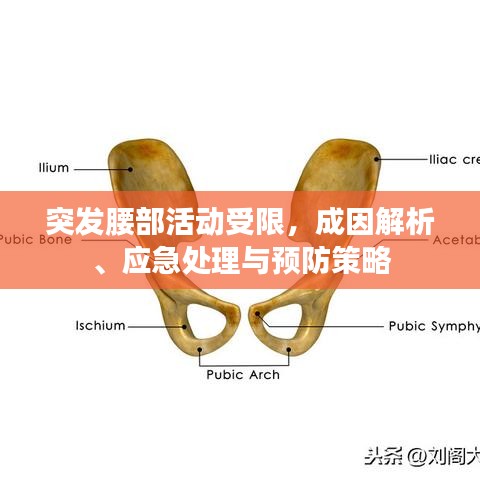 突發(fā)腰部活動(dòng)受限，成因解析、應(yīng)急處理與預(yù)防策略