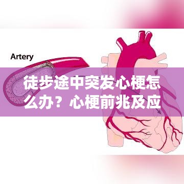 徒步途中突發(fā)心梗怎么辦？心梗前兆及應(yīng)對(duì)措施科普！