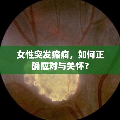 女性突發(fā)癲癇，如何正確應(yīng)對(duì)與關(guān)懷？