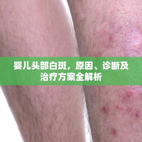 高抬貴手 第3頁