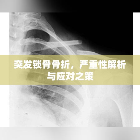 突發(fā)鎖骨骨折，嚴重性解析與應(yīng)對之策