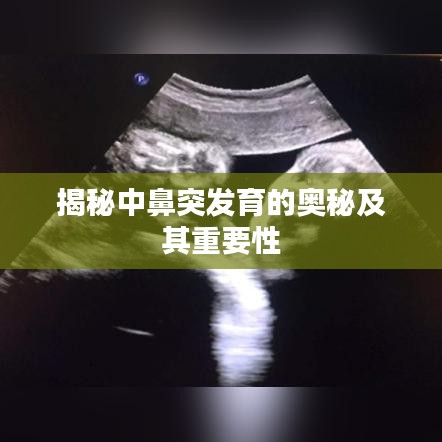 揭秘中鼻突發(fā)育的奧秘及其重要性