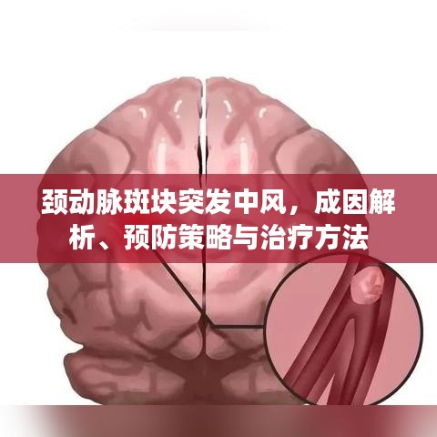頸動(dòng)脈斑塊突發(fā)中風(fēng)，成因解析、預(yù)防策略與治療方法